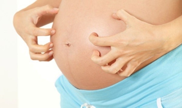 Псориаз во время беременности